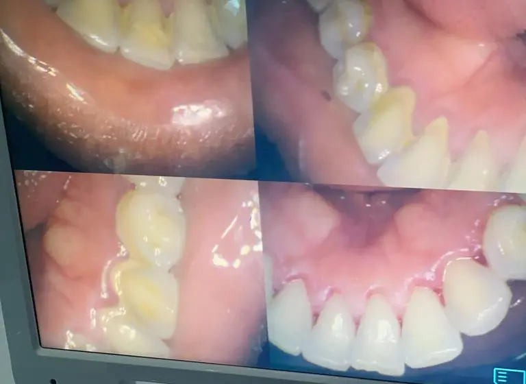 Routine Dental Check Up care in Ota, Ogun State