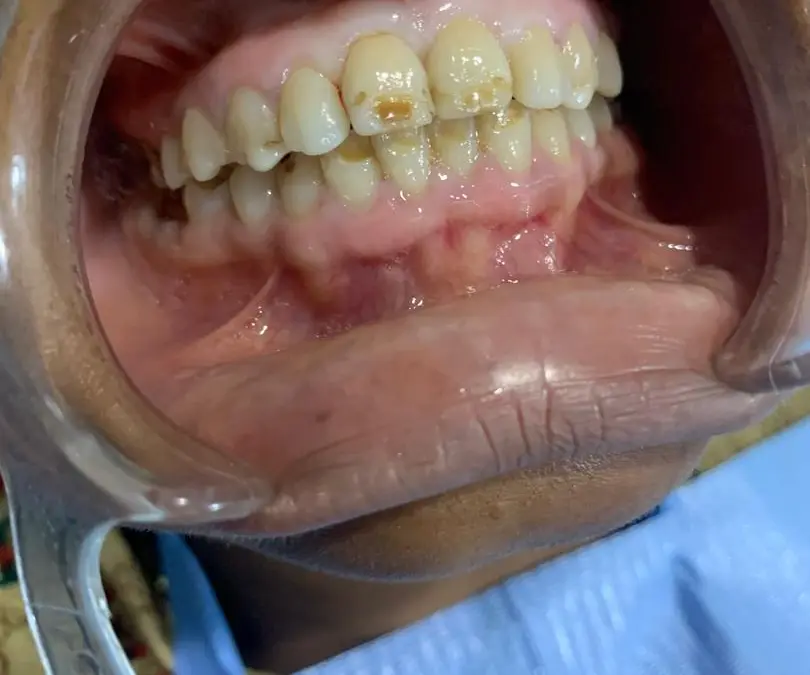 Routine Dental Check Up at Royal Aesthetics Dental Clinic in Ota